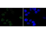Progesterone Receptor Recombinant Rabbit Monoclonal Antibody (JF0549)