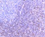Bcl-2 Antibody in Immunohistochemistry (Paraffin) (IHC (P))