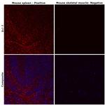 Bcl-2 Antibody in Immunohistochemistry (Paraffin) (IHC (P))