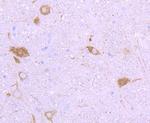 NF-H Recombinant Rabbit Monoclonal Antibody (JF99-07)