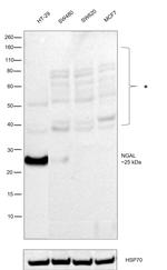 NGAL Antibody in Western Blot (WB)