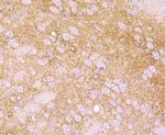 Ly-6A Antibody in Immunohistochemistry (Paraffin) (IHC (P))