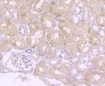 Ly-6A Recombinant Rabbit Monoclonal Antibody (JM53-11)