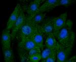 BNIP3 Recombinant Rabbit Monoclonal Antibody (JA71-10)