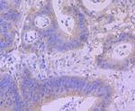 BNIP3 Antibody in Immunohistochemistry (Paraffin) (IHC (P))