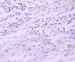 GATA1 Recombinant Rabbit Monoclonal Antibody (JA10-32)
