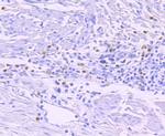 GATA1 Antibody in Immunohistochemistry (Paraffin) (IHC (P))