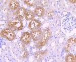 GATA1 Antibody in Immunohistochemistry (Paraffin) (IHC (P))