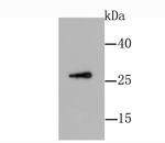 GDNF Recombinant Rabbit Monoclonal Antibody (JA93-10)