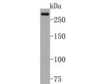 CHD4 Antibody in Western Blot (WB)