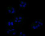 JAK3 Recombinant Rabbit Monoclonal Antibody (JM66-31)