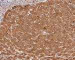 Ferritin Heavy Chain Antibody in Immunohistochemistry (Paraffin) (IHC (P))