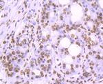 Histone H2A.X Recombinant Rabbit Monoclonal Antibody (JM06-42)