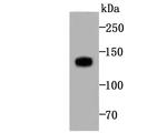 Involucrin Antibody in Western Blot (WB)