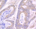 N-WASP Antibody in Immunohistochemistry (Paraffin) (IHC (P))