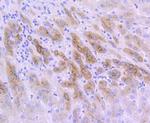 IGFBP2 Recombinant Rabbit Monoclonal Antibody (JU37-46)