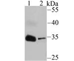 IGFBP2 Antibody in Western Blot (WB)
