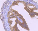 GIT1 Recombinant Rabbit Monoclonal Antibody (JU33-39)