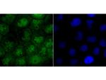 CRM1 Antibody in Immunocytochemistry (ICC/IF)