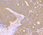 PCK2 Antibody in Immunohistochemistry (Paraffin) (IHC (P))