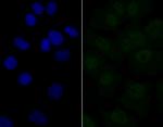 eIF4A3 Recombinant Rabbit Monoclonal Antibody (JG35-33)
