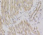 alpha Actinin 2 Recombinant Rabbit Monoclonal Antibody (JE45-22)