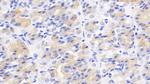 ACVR2A Antibody in Immunohistochemistry (Paraffin) (IHC (P))