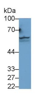 ACVR2A Antibody in Western Blot (WB)