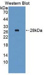 GPT Antibody in Western Blot (WB)