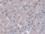 ORM1 Monoclonal Antibody (D6)