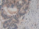 Amphiregulin Monoclonal Antibody (A6)
