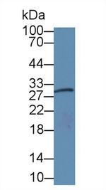 Amphiregulin Antibody in Western Blot (WB)