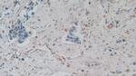 Amphiregulin Monoclonal Antibody (A5)