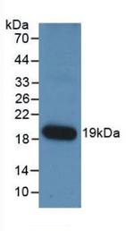Angiopoietin 1 Monoclonal Antibody (E1)