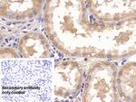 Annexin V Antibody in Immunohistochemistry (Paraffin) (IHC (P))