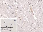 Annexin V Antibody in Immunohistochemistry (Paraffin) (IHC (P))