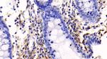 Annexin V Antibody in Immunohistochemistry (Paraffin) (IHC (P))