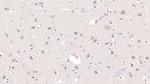 APOL2 Monoclonal Antibody (C1)