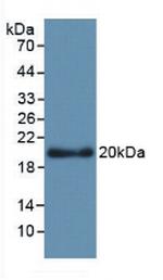 APOL2 Antibody in Western Blot (WB)