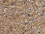 Aquaporin 4 Antibody in Immunohistochemistry (Paraffin) (IHC (P))