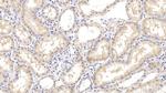 Arginase 2 Monoclonal Antibody (D3)