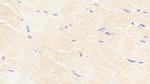 BMP3 Antibody in Immunohistochemistry (Paraffin) (IHC (P))