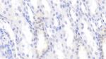 BMP3 Antibody in Immunohistochemistry (Paraffin) (IHC (P))