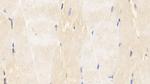 Caspase 6 Antibody in Immunohistochemistry (Paraffin) (IHC (P))
