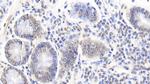 Caspase 6 Antibody in Immunohistochemistry (Paraffin) (IHC (P))