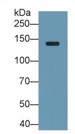 Ceruloplasmin Antibody in Western Blot (WB)
