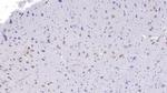 Uteroglobin Monoclonal Antibody (C2)