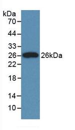 Apolipoprotein J Antibody in Western Blot (WB)