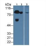 Prothrombin Antibody in Western Blot (WB)