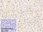Prothrombin Monoclonal Antibody (C10)